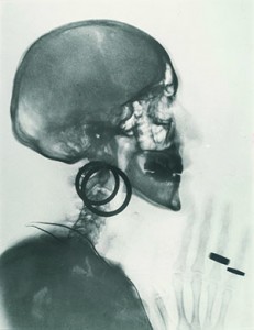 Radiografische fotografie. Meret Oppenheim, Röntgenaufnahme des Schädels M. O. (1964). Particuliere collectie.